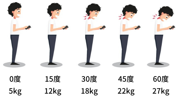 首こり病（頸性神経筋症候群）とは？スマホ首が原因の不調を根本改善